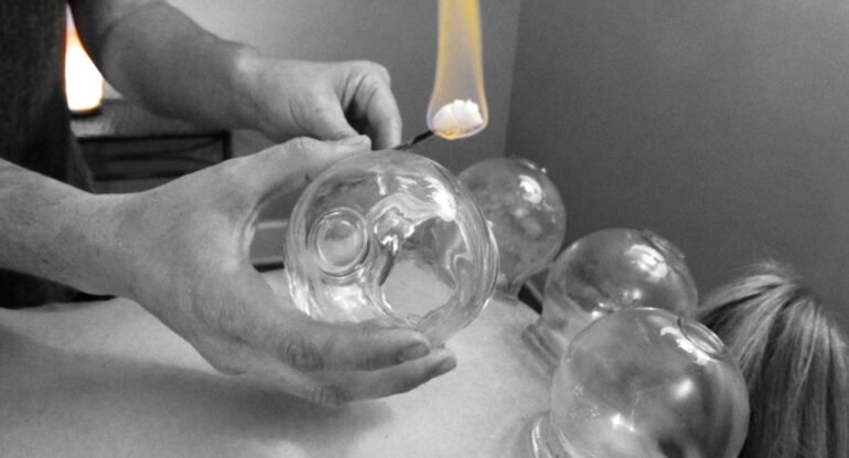 Top 10 Benefits of Acupuncture Backed by Science