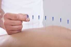 Are There Disadvantages of Acupuncture
