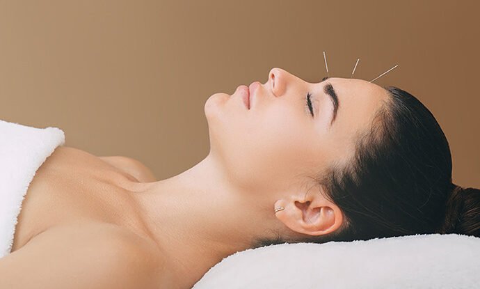 Can Acupuncture Help with Sleep and Anxiety