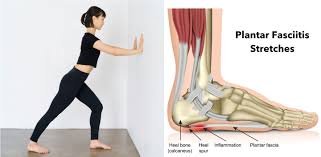 Shock Wave Therapy Treats Plantar Fasciitis