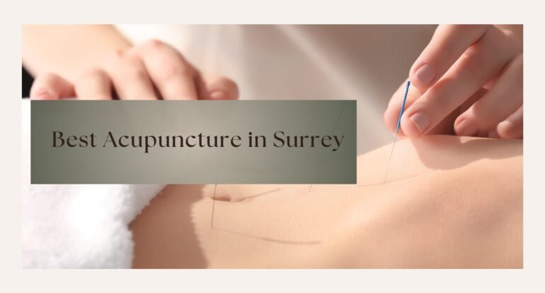 Best Acupuncture in Surrey