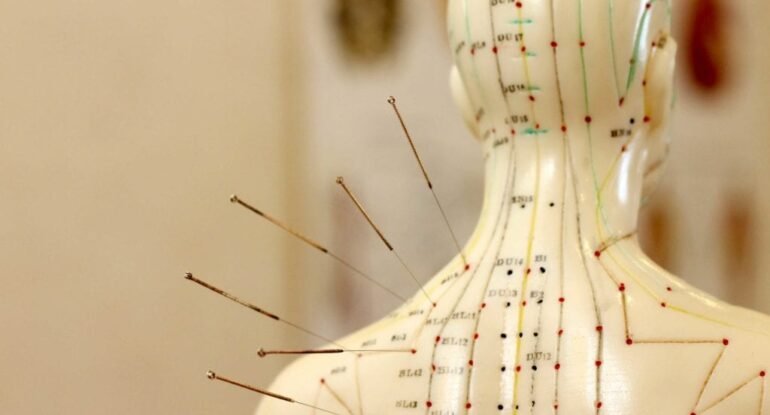 Questions About Acupuncture & TCM