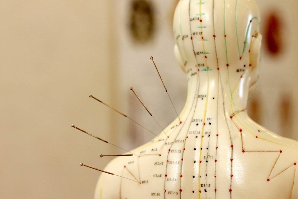 Questions About Acupuncture & TCM
